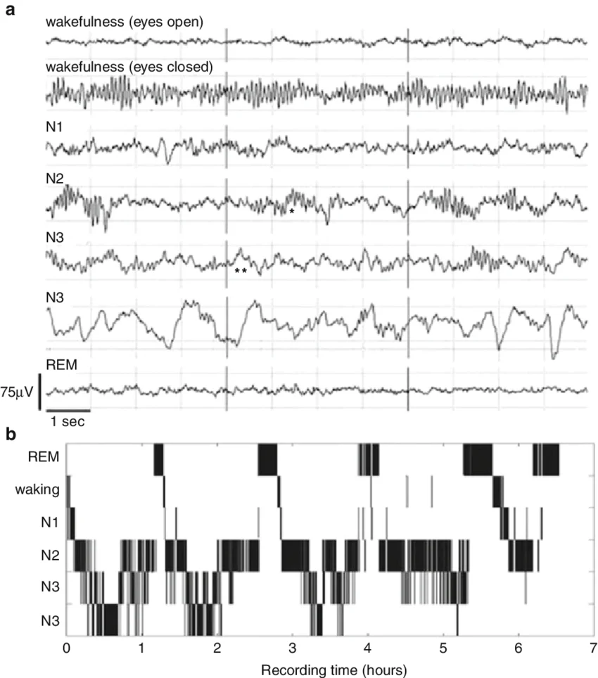 Lucid Dreaming: A Safe Entry into Your Own Unconscious